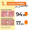 image:imagenumbuzin No1 Easy Peasy Cleansing Oil Lightweight Makeup Remover amp Facial Cleanser Waterproof Makeup amp Blackhead Care Corn amp Macadamia Seed Oil FragranceFree 676 fl oz