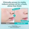 image:imagenumbuzin No1 Powder  Pantothenic Skincare 100 Powder  24H LongLasting Finish  Silica  Pantothenic Acid  CICA  For AcneProne Skin  024 oz