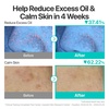 image:imagenumbuzin No1 Serum  Pantothenic B5 Active Soothing Serum  Soothing Hydrating  Pantothenic Acid Niacinamide  Excess Oil Control Reduces Breakouts Acne  Oily AcneProne Skin  169 fl oz