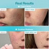 image:imagenumbuzin No1 Sheet Mask  Pantothenic B5 Hyaluronic Active Clear Mask  Calming Soothing Hydrating  Acne Prone Skin  Controls Excess Oil Reduces Redness  5 Sheets5 Count Pack of 1