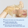 image:imagenumbuzin No4 Sheet Mask  Icy Soothing Sheet Mask  Instant Cooling Hydrating with Tea Tree Extract Bergamot Leaf Extract  Soothes Relieves Heated Skin  Korean Skincare  5 sheets1 Count Pack of 5