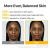 image:imagenumbuzin No5 Glutathione TXA Dark Spot Ampoule Targeted Tone Care Concentrate for Dark Spots amp Uneven Skin Tranexamic Acid Niacinamide Vitamin Tree Water Korean Skincare 107g035 Fl Oz Pack of 1