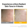 image:imagenumbuzin No5 Sheet Mask  Vitamin Spotlight Sheet Mask  Glutathione and Vitamin C  Reduces Hyperpigmentation Improves Skin Complexion  Gentle and nonirritating  5 sheet5 Count Pack of 1
