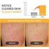 image:imagenumbuzin No5 VitaminNiacinamide Concentrated Pad Daily DoubleSided Facial Pads with Glutathione PHA amp LHA for a Fresh RadiantLooking Skin Finish 180 ml 70 PadsNo3 Radiance Glowing Jumbo Essence