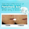 image:imagenumbuzin No1 Acne amp Sebum Control Set  Calming Herb Toner  B5 Soothing Cream for Redness and Breakouts