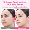 image:imagenumbuzin No2 Sheet Mask  Rose PDRN Collagen Plumping Sheet Mask  Korean Mask for face  Brightening Hydrating Firming and Moisturizing  Collagen Peptides PDRN  5 sheets
